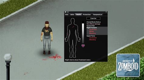You die. . Bite project zomboid